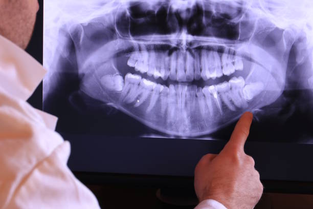 Best Emergency Tooth Extraction in Shadybrook, TX